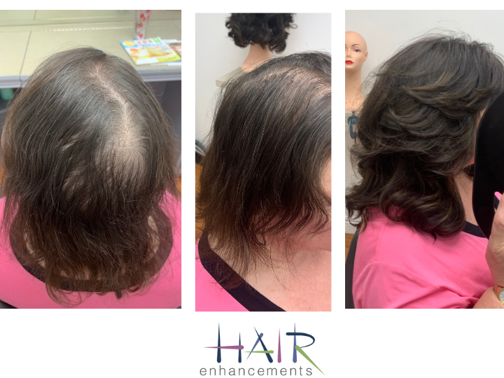 All women experience hair loss at some point. – Hair Enhancements